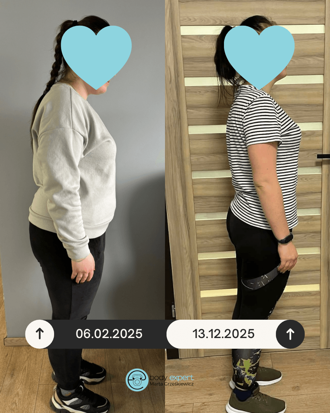 beige minimalist skincare before and after instagram post (1080 x 1350 px) 1