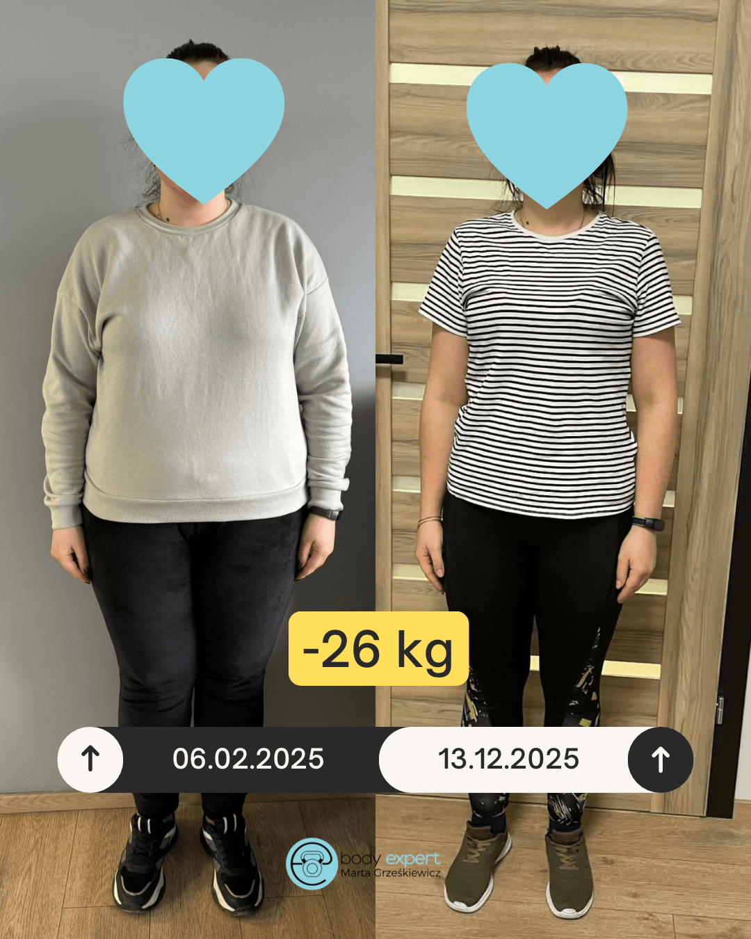 beige minimalist skincare before and after instagram post (1080 x 1350 px) 2