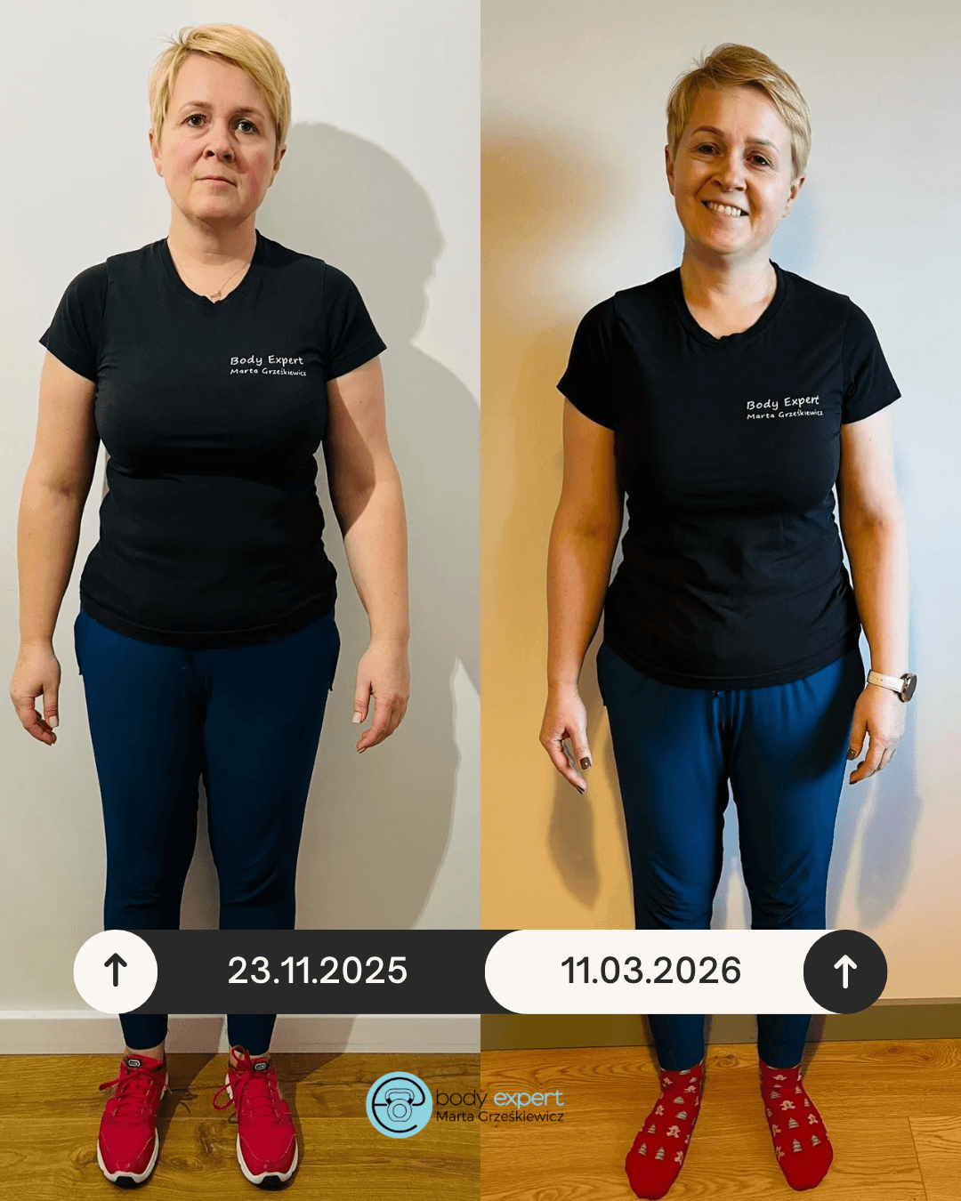 beige minimalist skincare before and after instagram post (1080 x 1350 px) 3