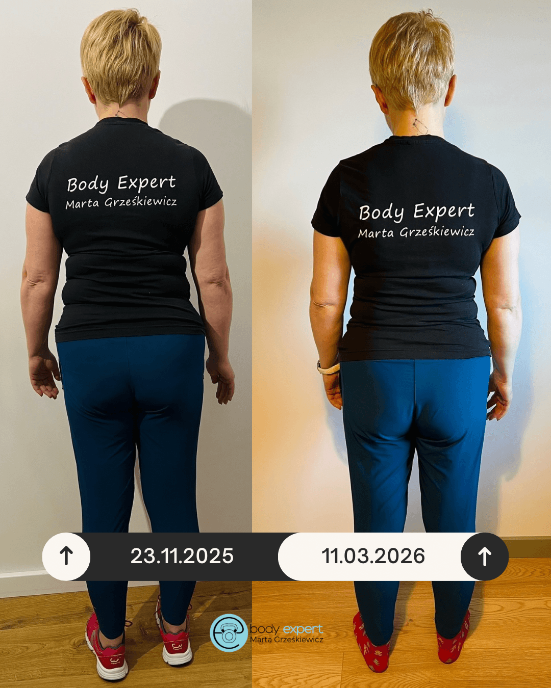 beige minimalist skincare before and after instagram post (1080 x 1350 px) 4