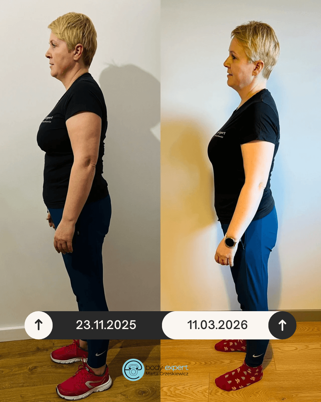 beige minimalist skincare before and after instagram post (1080 x 1350 px) 5