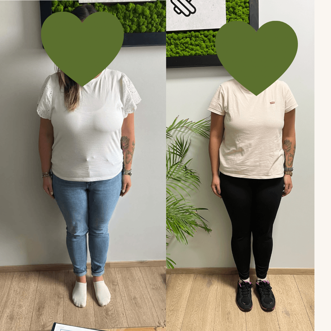 beige minimalist skincare before and after instagram post 2