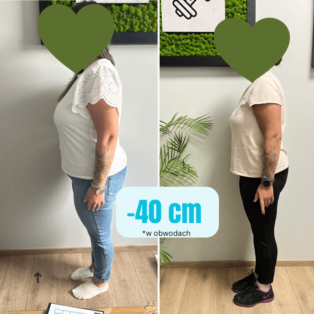 beige minimalist skincare before and after instagram post 4